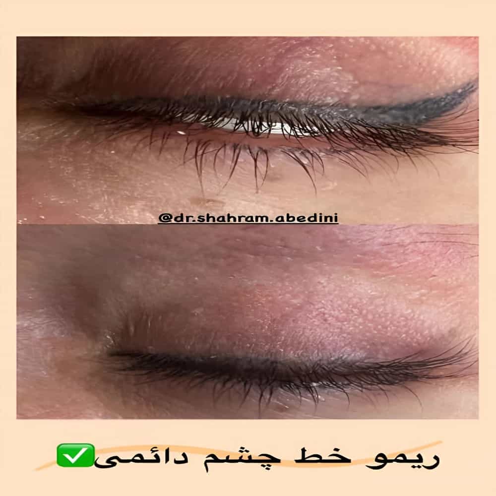 1785138164033.webp