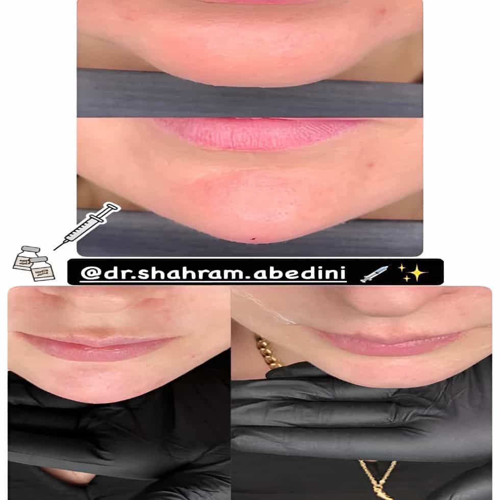 1785138225910.webp