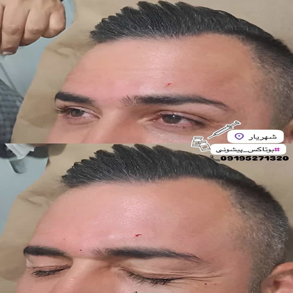 1785138240970.webp