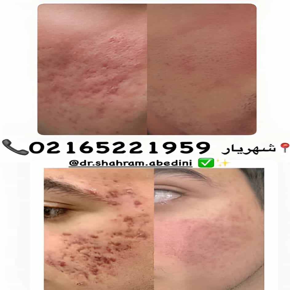 1785138575644.webp